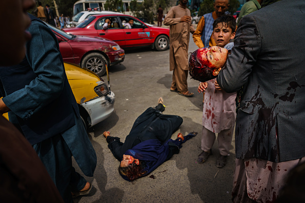 BRUTALITY: Harrowing Images Show Barbaric Taliban Imposing Islamic Law